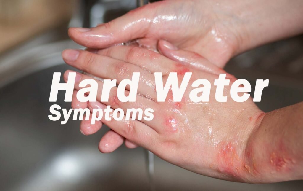 Hard Water Symptoms