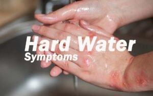 Hard Water Symptoms
